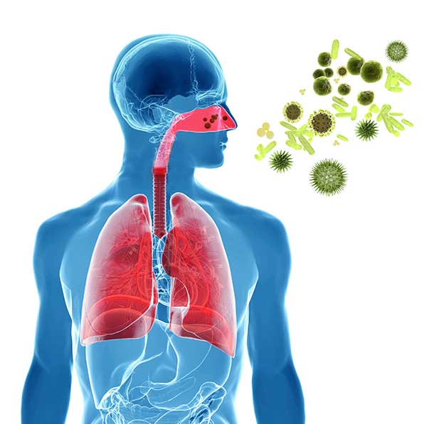 Illustration allergisches Asthma bronchiale