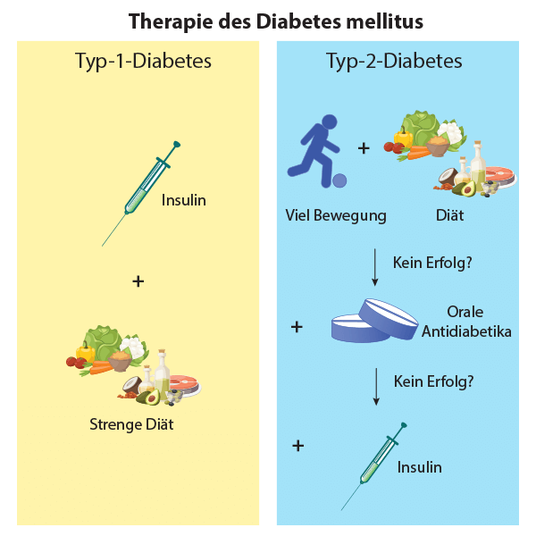 Infographik Therapie von Diabetes Typ 1 und von Diabetes Typ 2